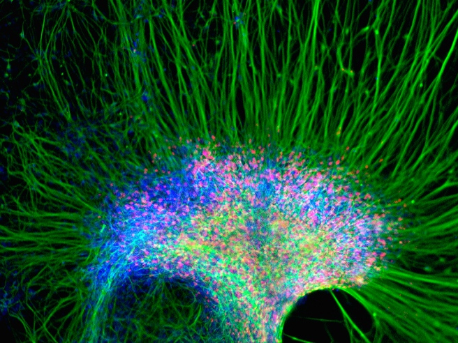 Figure 1 - A cluster of neural cells derived from stem cells in the lab of UW-Madison stem cell researcher and neuro-developmental biologist Su-Chun Zhang. The motor neurons are shown in red; neural fibers appear green and the blue specks indicate DNA in cell nuclei. 